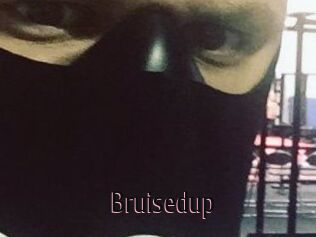 Bruisedup